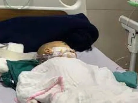 Uống nhầm dầu hỏa, bé trai nguy kịch