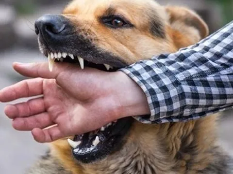 Đắk Lắk: Cụ bà 78 tuổi tử vong sau nhiều tháng bị chó cắn