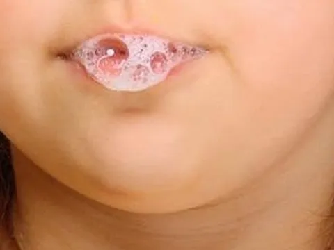 Thực hư bôi nước bọt vào buổi sáng lên vùng da mụn có thể khiến mụn 'biến mất'