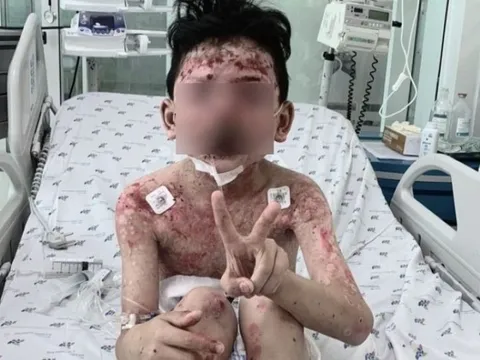 Bé trai bỗng mắc “hội chứng lạ” sau 2 ngày ăn thịt cua