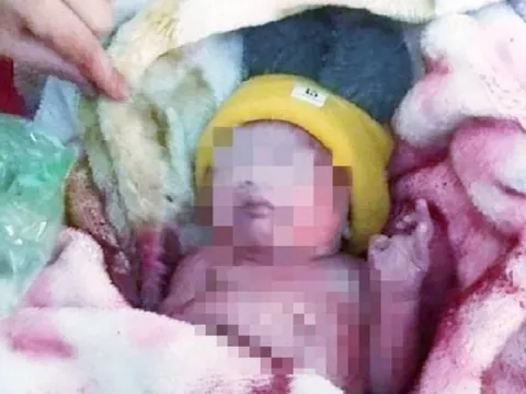 Phát hiện bé trai sơ sinh còn nguyên bánh nhau, dây rốn bị bỏ rơi