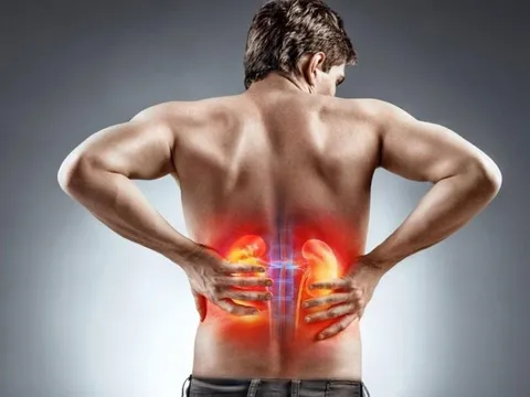 Bác sĩ cảnh báo: Làm 2 việc này thường xuyên, chắc chắn thận sẽ chịu không nổi
