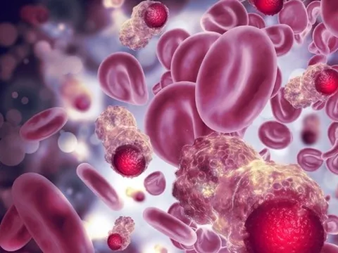 Cảnh báo: Điều nhiều người xem nhẹ có thể kích hoạt ung thư máu