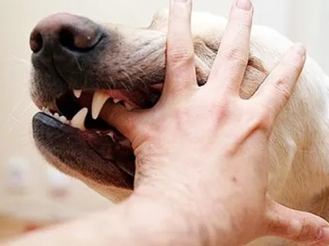 Người phụ nữ ở Vĩnh Phúc tử vong sau 3 tháng bị chó nhà cắn