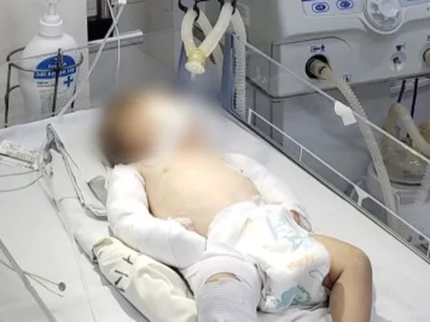 Sức khỏe bé gái 3 tháng tuổi ở Đà Lạt bị người tình của mẹ bạo hành giờ ra sao?