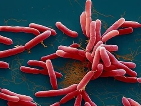 Bé 2 tuổi ở Đắk Lắk tử vong vì nhiễm vi khuẩn 'ăn thịt người' Whitmore