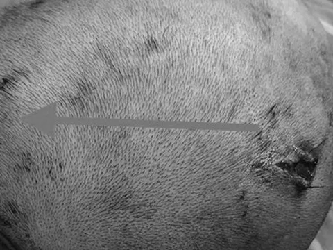 Bình ga mini trong đống rác phát nổ khiến bé gái hôn mê