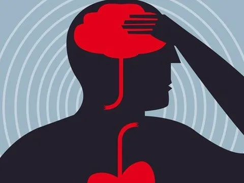 Nghiên cứu: Những người bị đau ở vùng này có nguy cơ mắc đột quỵ sớm hơn
