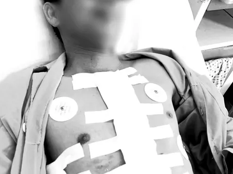 Ngoạn mục, các bác sĩ cứu sống người đàn ông vỡ tim