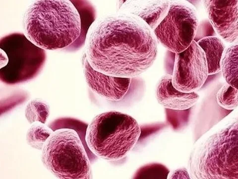 Máu có 3 chỉ số bất thường này, cần đi khám càng sớm càng tốt