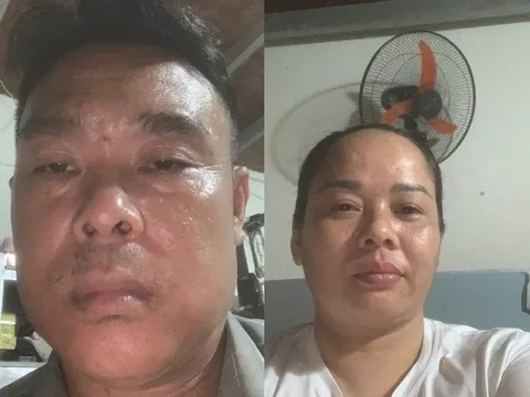 Bắt giữ đôi vợ chồng ép người già, người khuyết tât đi xin ăn