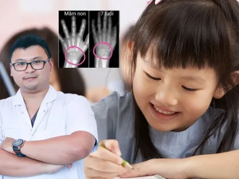 Cho trẻ tập viết quá sớm sẽ ảnh hưởng đến sự phát triển của xương: Bác sĩ chuyên khoa nói gì?