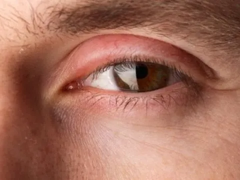 Đôi mắt nói gì về sức khỏe của bạn?