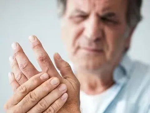 Sưng 5 vị trí này trên cơ thể, cẩn thận gan nhiễm mỡ giai đoạn cuối