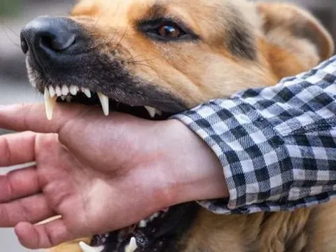 Người đàn ông tử vong sau 4 tháng bị chó dại cắn