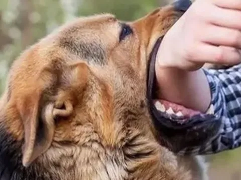 Người đàn ông tử vong sau hơn 4 tháng bị chó cắn