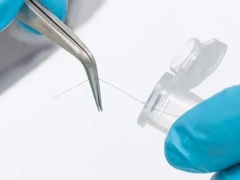 Con đẹp hơn hẳn bố mẹ, bố nghi ngờ đi xét nghiệm ADN và cái kết khó tin