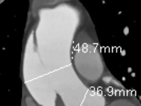 Đau ngực kéo dài, coi chừng đột tử