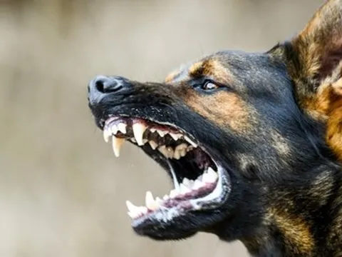 Bé 3 tuổi bị chó lai 40kg cắn đứt xương hàm