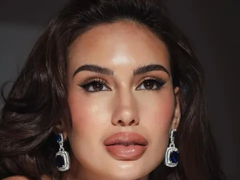 Hoa hậu Hoàn vũ Philippines bị chê gương mặt như thẩm mỹ hỏng