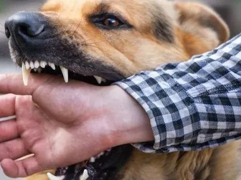 Đồng Nai: Điều tra dịch tễ, khoanh vùng sau khi 5 người bị chó dại cắn