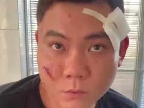 Khánh Hòa: Xác định nghi can vụ nổ súng làm 2 người bị trúng đạn