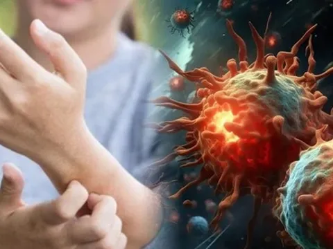 80% bệnh nhân ung thư tuyến tụy có chung '1 triệu chứng không ngờ tới'