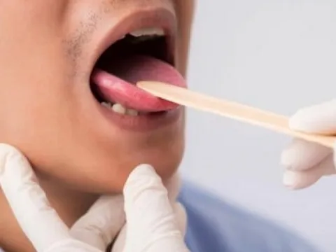 Đi khám vì có dấu hiệu lạ trong miệng, không ngờ nguyên nhân là ung thư