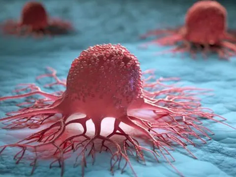 Đột phá từ Mỹ: Tìm ra cách khiến tế bào ung thư tự hủy