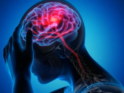 Sống sót sau khi bị đột quỵ ở tuổi 20, cô gái trẻ chỉ ra triệu chứng mà mình đã bỏ qua