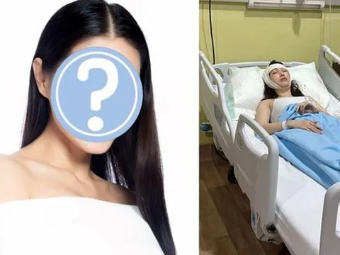 Siêu mẫu kiêm diễn viên ngã cầu thang, bị thương đến mức phải phẫu thuật vì lý do hi hữu