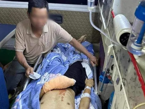 Hà Tĩnh: Nam sinh lớp 12 đứt lìa bàn tay sau tiếng nổ