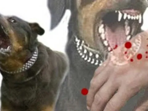 Đắk Nông: 1 trẻ tử vong do bệnh dại sau 40 ngày bị chó cắn