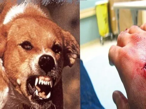 Người đàn ông ở Quảng Ngãi tử vong sau 2 tháng nghi bị chó dại cắn