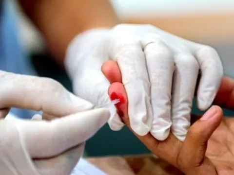 Vụ 'bông hồng đen' lấy mẫu máu học sinh: Ai được phép lấy mẫu xét nghiệm HIV?