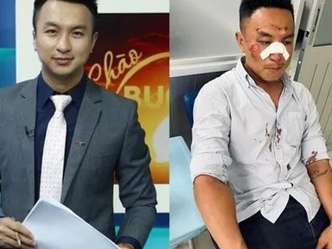 Cựu MC “Chào buổi sáng” VTV1 bị tai nạn giao thông nặng ảnh hưởng đến khuôn mặt