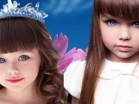 Bé gái từng gây sốt với khuôn mặt đẹp như búp bê bây giờ thế nào?