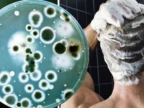 Bác sĩ cảnh báo: Không vệ sinh thứ này trong phòng tắm đúng cách có thể gây tổn thương da, phổi