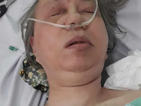 TP HCM: Bác sĩ tìm người thân cho 1 phụ nữ bất tỉnh giữa đường