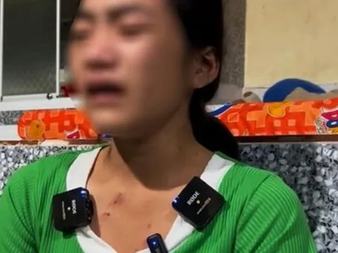 Tạm giữ đối tượng đánh đập thiếu nữ 16 tuổi