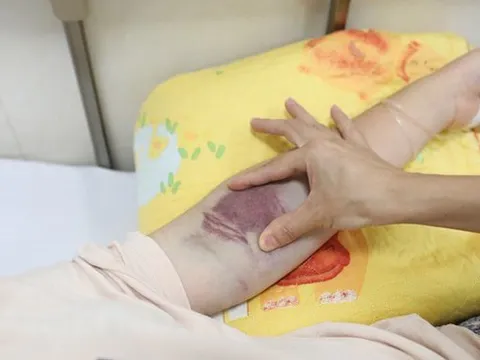 Hà Nội: Số bệnh nhân sốt xuất huyết tăng 4 lần so với cùng kỳ 2022, ghi nhận thêm 1 ca tử vong