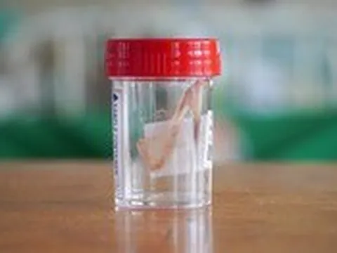 Nguy kịch vì tìm người "đẻ ngược" vuốt hóc xương