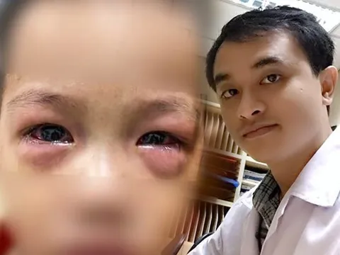 Bệnh đau mắt đỏ lây lan cả nước, bác sĩ đưa những cách hạn chế nhiễm bệnh trong giai đoạn này