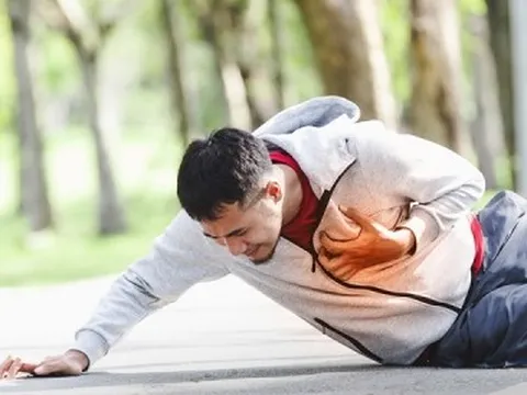 Làm gì để tránh đột quỵ khi chơi thể thao?