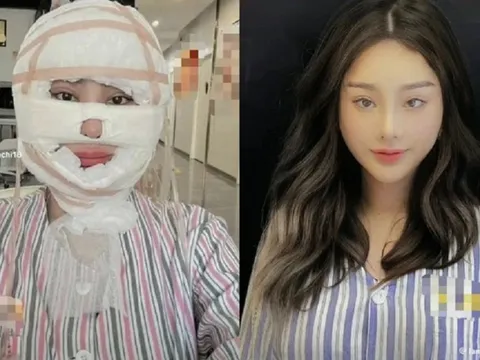 Khó nhận ra Lâm Khánh Chi sau màn “dao kéo” mới nhất