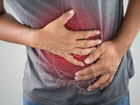 Hiệp hội Ung thư Hoa Kỳ: 6 việc cần làm sớm để ngăn ngừa ung thư đại trực tràng