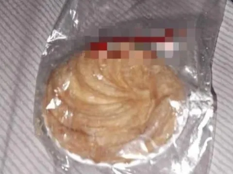 Bé 6 tuổi ngộ độc sau tiệc Trung thu: Lập hội đồng đánh giá quy trình tiếp nhận