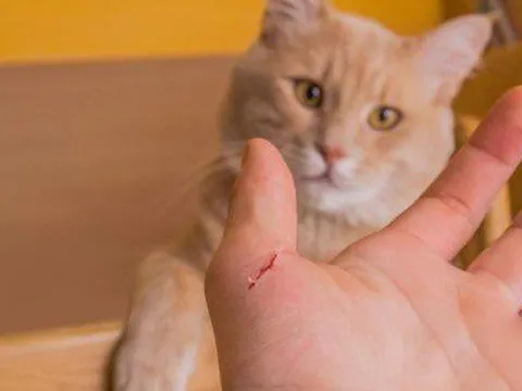 Người đàn ông 35 tuổi hôn mê, phải thở máy do bị mèo cắn