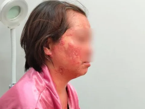 Nỗi đau của người phụ nữ mắc căn bệnh nhiều người không dám đến gần