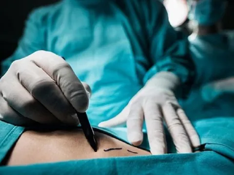 Bi kịch của hoa hậu tài năng qua đời vì biến chứng phẫu thuật thẩm mỹ
